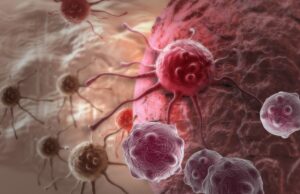 ¡Cuidado! El cáncer es dulce y te lo comes a diario